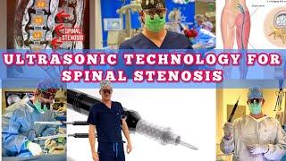 𝐔𝐥𝐭𝐫𝐚𝐬𝐨𝐧𝐢𝐜 Spine Surgery 𝐓𝐞𝐜𝐡𝐧𝐨𝐥𝐨𝐠𝐲 for Spinal Stenosis! 