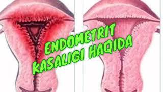 ENDOMETRIT QANDAY KASALIK? HAMMA AYOLLAR KO'RSIN!