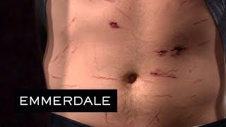 Emmerdale - Aaron's Bloodstained Stomach Is Revealed