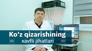 Ko'z qizarishi xavflimi? | Dr.Zohidjon