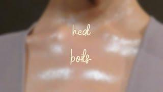 . *. ⋆ !! heal boils subliminal ¡¡ ´ˎ˗