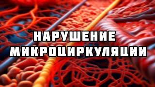 Нарушение микроциркуляции // Патофизиология (2 тема)