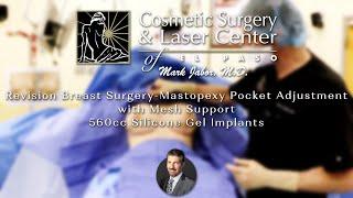 Cosmetic Surgery & Laser Center of El Paso I Revision Breast Surgery-Mastopexy Pocket Adjustment.