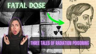 Three Terrifying Cases of Radiation Poisoning You Need to Know About