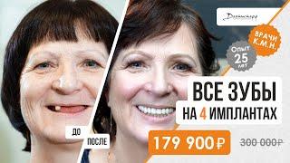 Восстановление всех зубов до/после. +7 (495) 255-59-37 Чудесное преображение пациентки! 18+