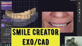 smile creator in exocad. Дизайн улыбки с помощью фото, цифровое моделирование зубов.