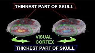 Brain Function Mapping