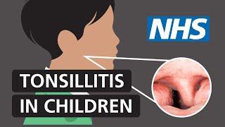 Tonsillitis in children: Symptoms and treatment | NHS