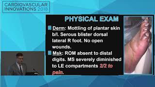 CVI2018 Session: Heparin Induced Thrombocytopenia - Preston Panicco