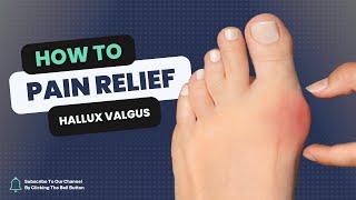 Get Your Toes In Line: A Guide To Fixing Hallux Valgus