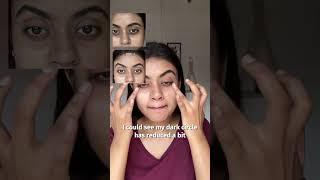 I Tried Vilvah’s Viral Eye Cream & The Results Shocked Me! 
