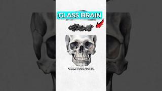 Archaeologists Discover Glass Brain