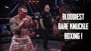 Most Brutal Russian Bare-Knuckle Boxing! RCC (HIGHLIGHTS)