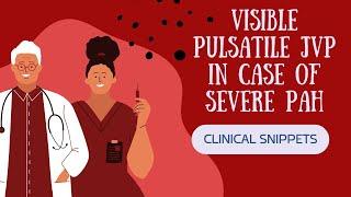 VISIBLE PULSATILE JVP IN CASE OF SEVERE PULMONARY ARTERY HYPERTENSION