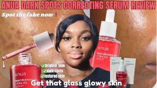 How To Get Rid Of Dark Spots Fast With Just One Productserum that works #review