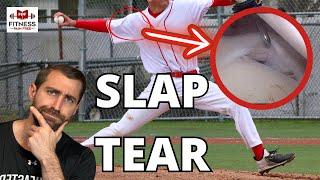 What Physical Therapists Need to Know About SLAP Tears