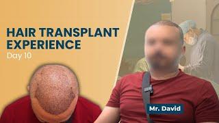 Mr David's hair transplant experience with SkinQure, Delhi | Dr Jangid