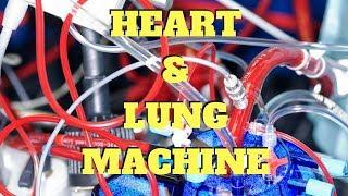 UNDERSTANDING THE HEART LUNG MACHINE