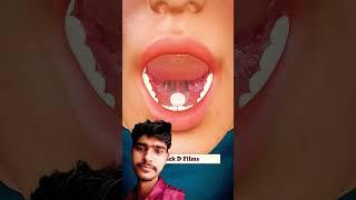 dawai kaise kam karti hai aaj bataen video mein  #doctor