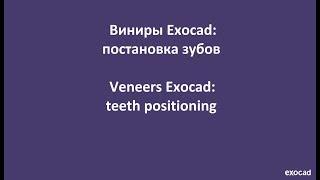 Виниры Exocad: 3) постановка зубов / Veneers Exocad: 3) teeth positioning