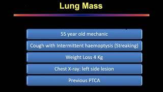 Lung Cancer case presentation