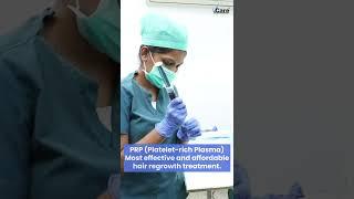 PRP - Most Effective Hair Regrowth Treatment | VCare Clinics