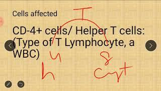 AIDS (NT exam)