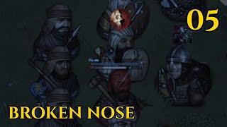 Broken Nose - Battle Brothers Season 14 - 05