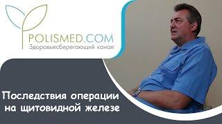 Последствия операции на щитовидной железе: вес, печень, кожа, волосы. Профилактика последствий