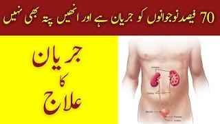 Jaryan Kia Hai? Alamaat Aur Ilaaj | Gonorrhoea | Gleet | URDU/HINDI | Hakeem Malik Ahmad Farooq