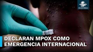 OMS declara emergencia internacional por brote de mpox, antes viruela del mono, en África