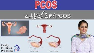 How to treat PCOS in Urdu/Hindi - Dr. Sophia Umair Bajwa - Family Fertility & IVF Center, Lahore
