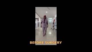 Wonderful results after knee replacement surgery in 65 year old female with severe Osteoarthritis