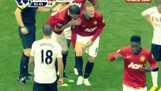 Wayne Rooney РАЗРЕЗ НОГИ.26.08.2012.Жесть!