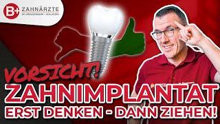 Lass dir KEINE IMPLANTATE setzen (bevor du dieses Video gesehen hast): Zahnarzt REALTALK!