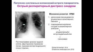 Лекция: Мультидисциплинарный подход к лечению острого и хронического панкреатита