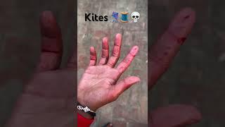 Dangerous Manjha#kite #kiteflying #manjha #youtubeshorts