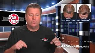 We Grow Hair Indy | Rick DeMulling & JMV Results