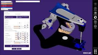 Prosystom + Exocad - Bite splint Functional