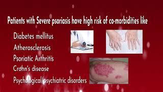 What is Psoriasis? What is the best treatment for Psoriasis? - Dr.JRK's Research