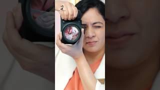 Camera Reel Effect | Best Dermatologist in Rishikesh  | Dr. Sridevi Esthetiques