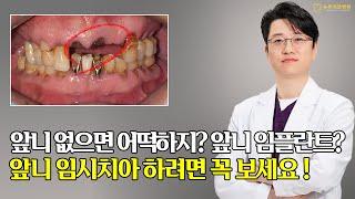 [부산전체임플란트] 앞니 없으면 어떡하지 !? 감쪽같은 앞니 임플란트 치료 !