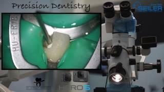 Seiler Precision Dentistry GoPro