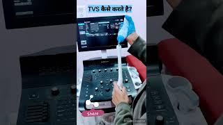 TVS#transvaginal sonography #ultrasound #gynecologist #gyne #doctorslife