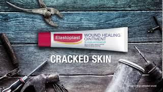 Top 5 uses of Elastoplast Wound Healing Ointment