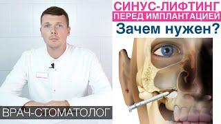 Синус-лифтинг - что это, зачем нужен, методики синус-лифтинга (закрытый и открытый)