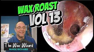 WAX ROAST VOL 13! #ear #earwax #earwaxremoval #earwaxclinic #satisfying #foryou #fyp #foryourpage