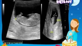 nine's ultrasound with love song.avi