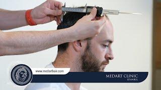 Hair Transplant Turkey | Medart Hair Clinic Istanbul