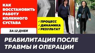 Перелом мыщелка большеберцовой кости. Реабилитация после травмы и операции. Дневник лечения.